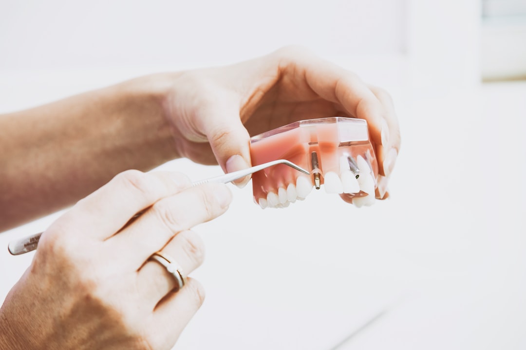 Find the Best Dental Implants Near Me